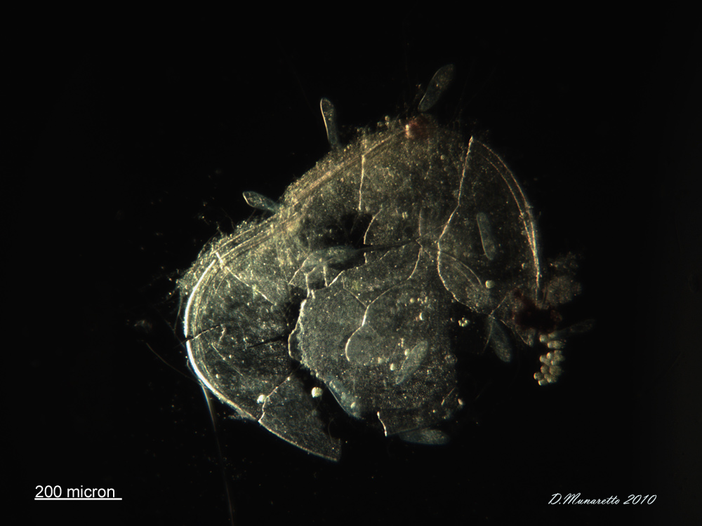 Parameci VS Ostracode